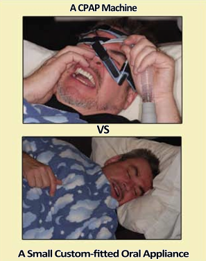 Cpap