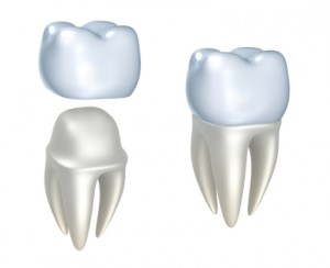 CEREC Dental Crowns In Newport News CEREC Dental Crowns In Newport News