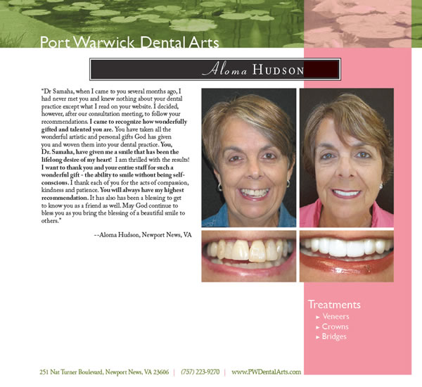 Before and After Cosmetic Dentistry Newport News Restorative
