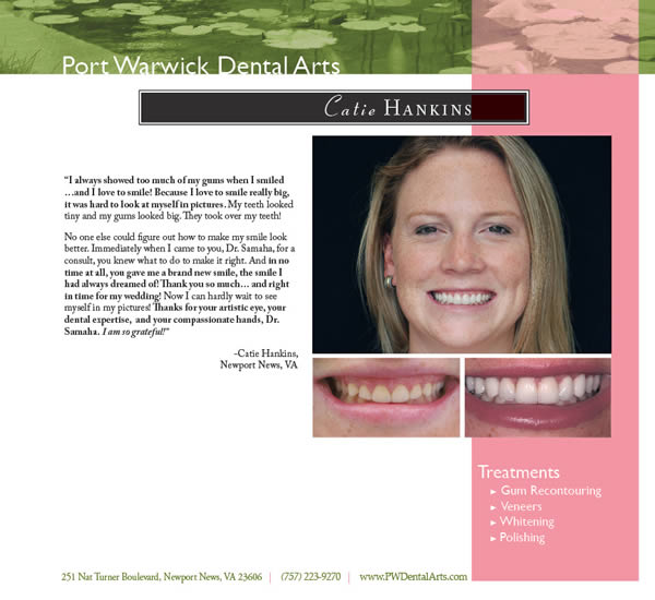 Before and After Cosmetic Dentistry Newport News Restorative