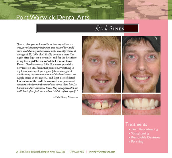 Before and After Cosmetic Dentistry Newport News Restorative