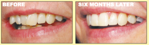 Cosmetic Dentistry In Newport News Cosmetic Dentistry In Newport News